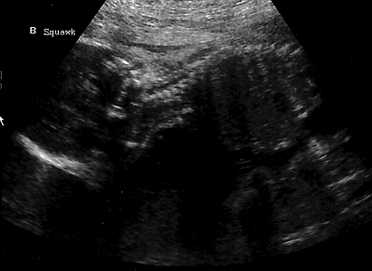 Squawk 24 week ultrasound